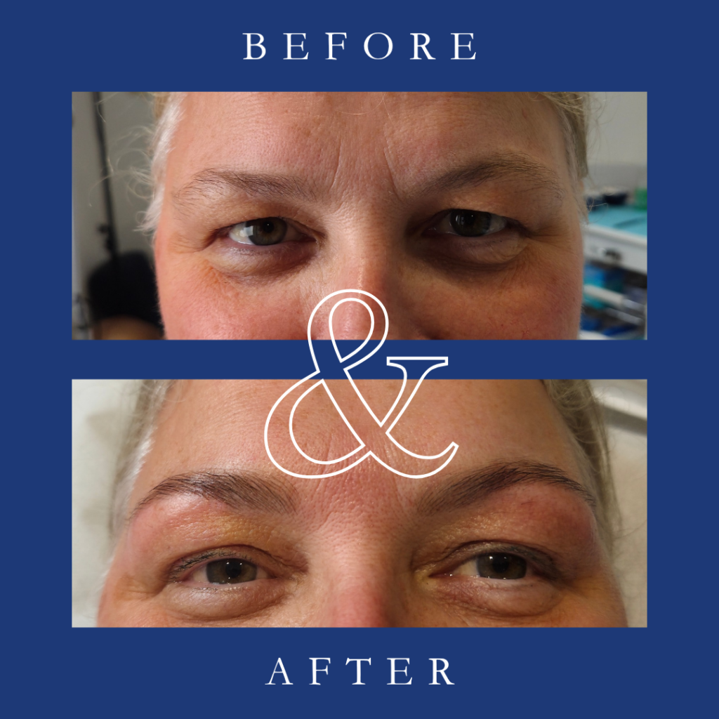 black and white lash tech before and after instagram post 20250425 051548 0001