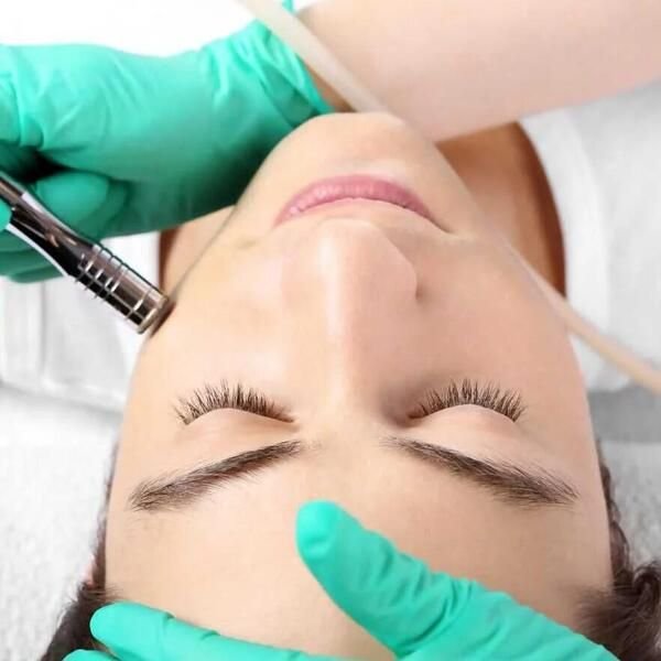 diamond microdermabrasion