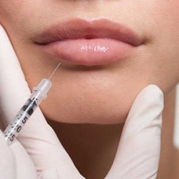 ha dermal filler