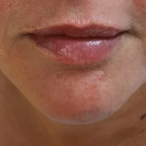 img 20220610 093453 598