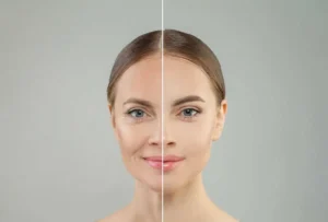 skinvive